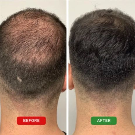 Roota Root Activator Spray Before After